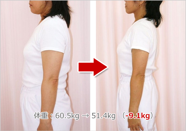 大澤接骨院のビフォーアフター03