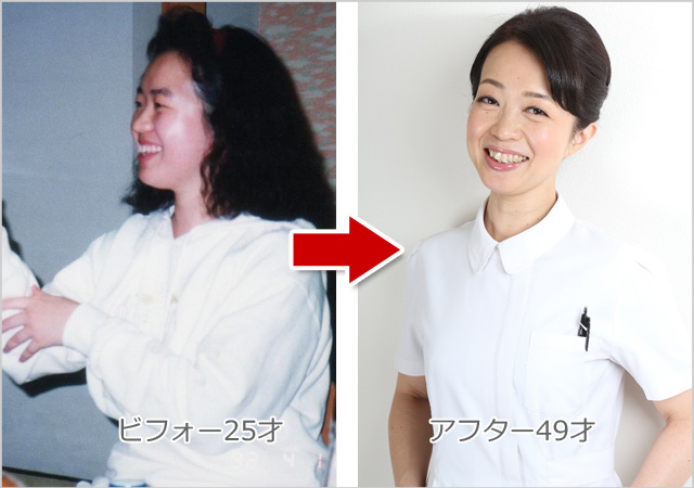 大澤接骨院のビフォーアフター04